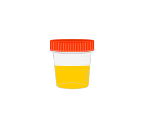 urine testing for drugs and alcohol